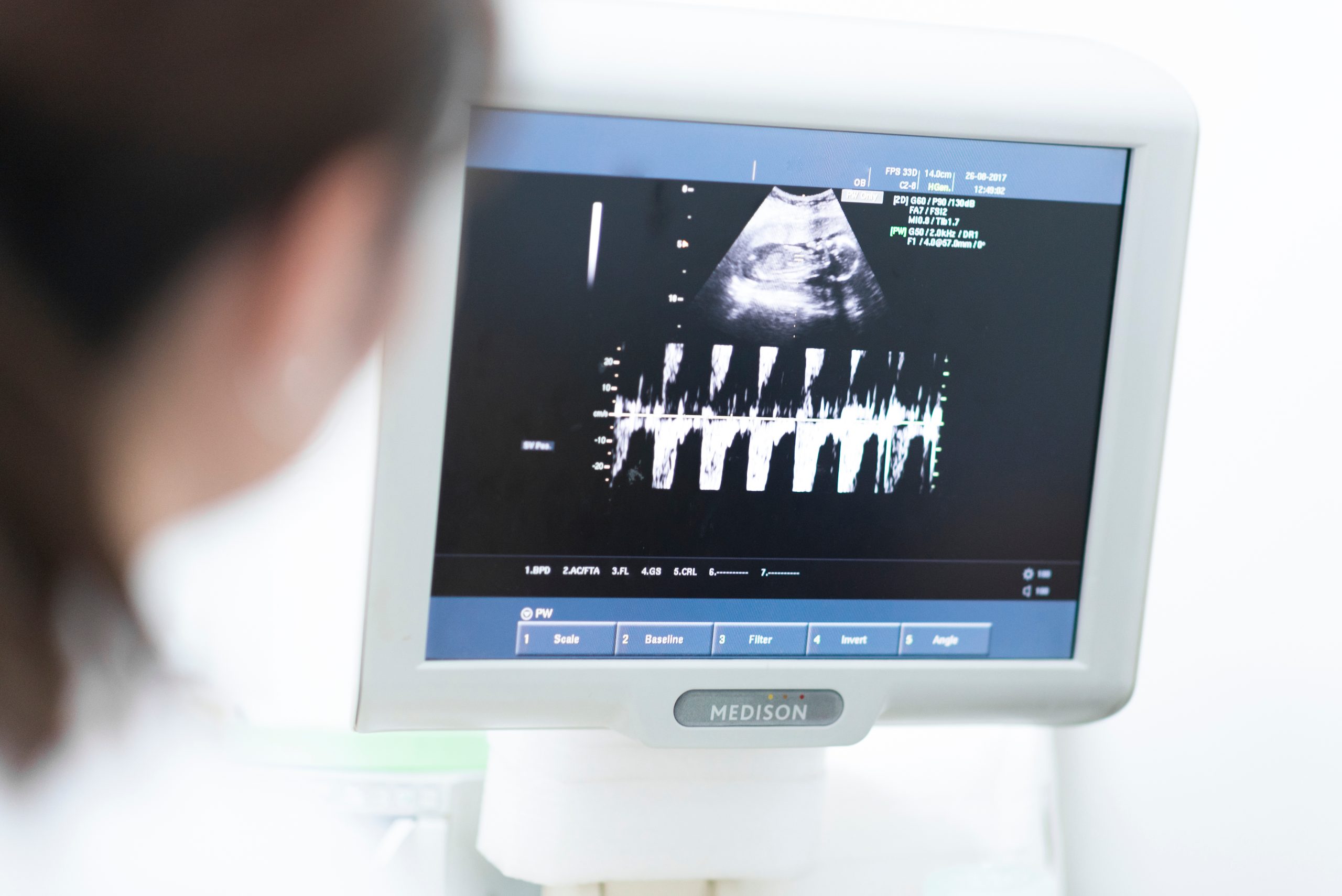 Ultrasound image in monitor