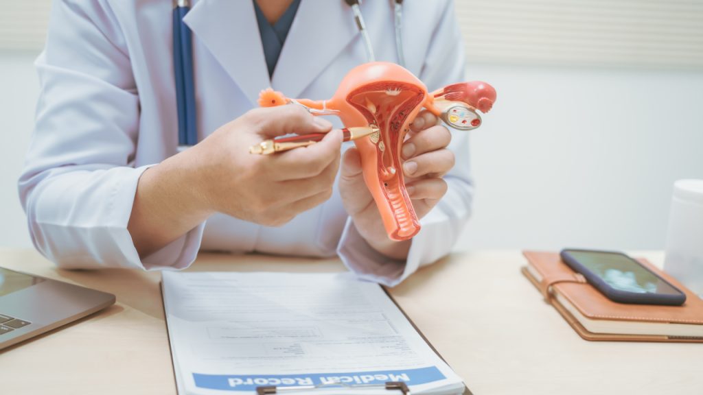 Doctor at a desk holding a uterus model beside a patient's medical record