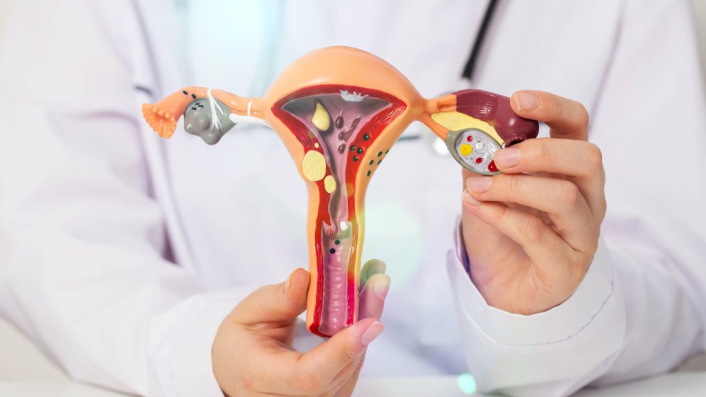 Ovarian cyst removal.