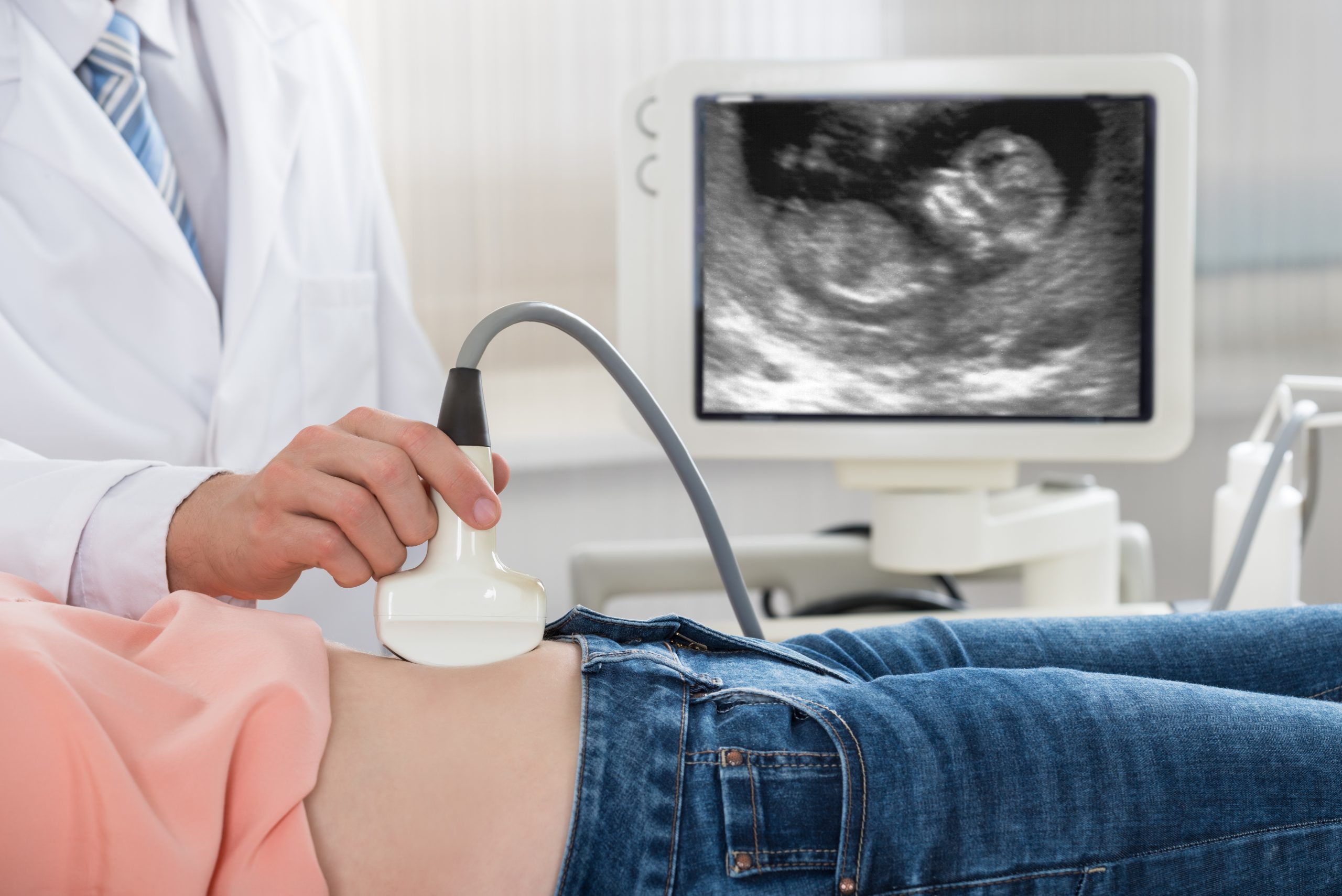 A woman getting an ultrasound scan during pregnancy after fibroid treatment.